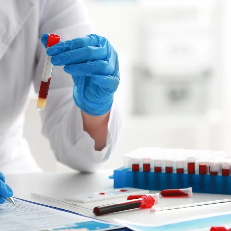 Blood Monitored MRD Testing for NonSecretory Myeloma image