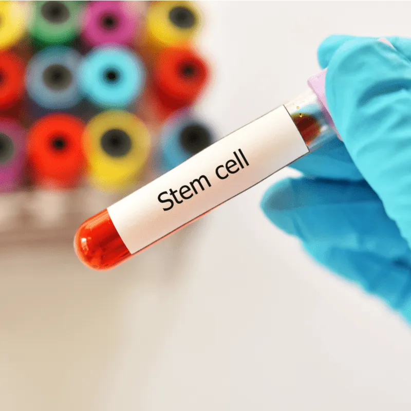 Exploring Stem Cell Transplant Experiences image