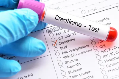 What Are Natural Ways To Reduce Creatinine Levels? image