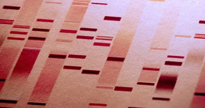 What is Translocation t(14;18) in Follicular Lymphoma? image