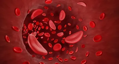 What Does Erythrocytosis Mean? image