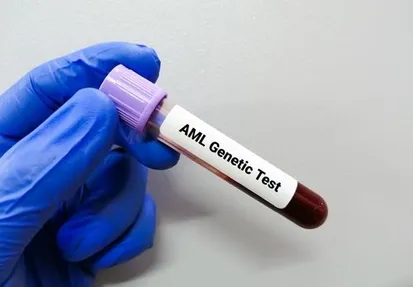 101 article: Types of AML