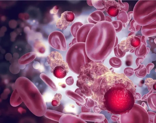 Multiple Myeloma: Advancements Improve Outlook for People with Blood Cancer image