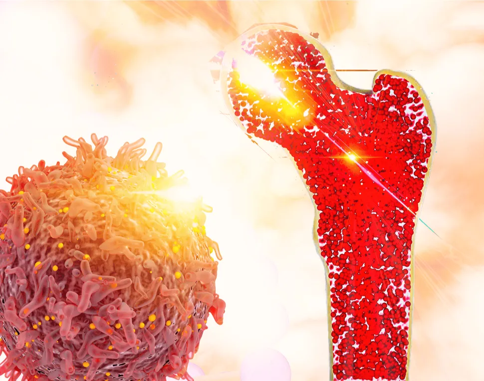 Targeting Bone Cells to Stop AML image