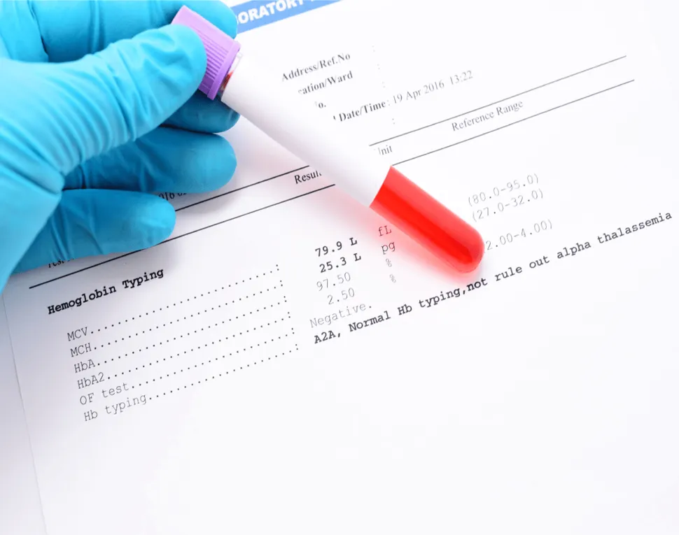 Full Adult AML Chapter Event: Understanding your AML Labs (and BMB Results) image
