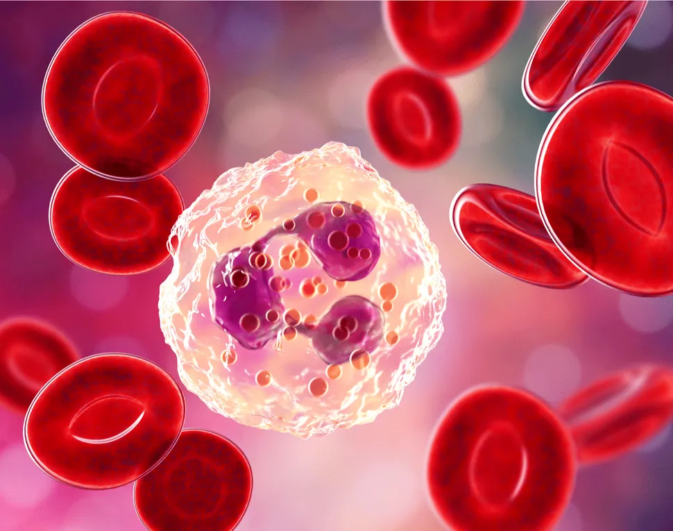Romyelocel-L: An Immune Cell Treatment Shown to Prevent Infections in AML Patients image