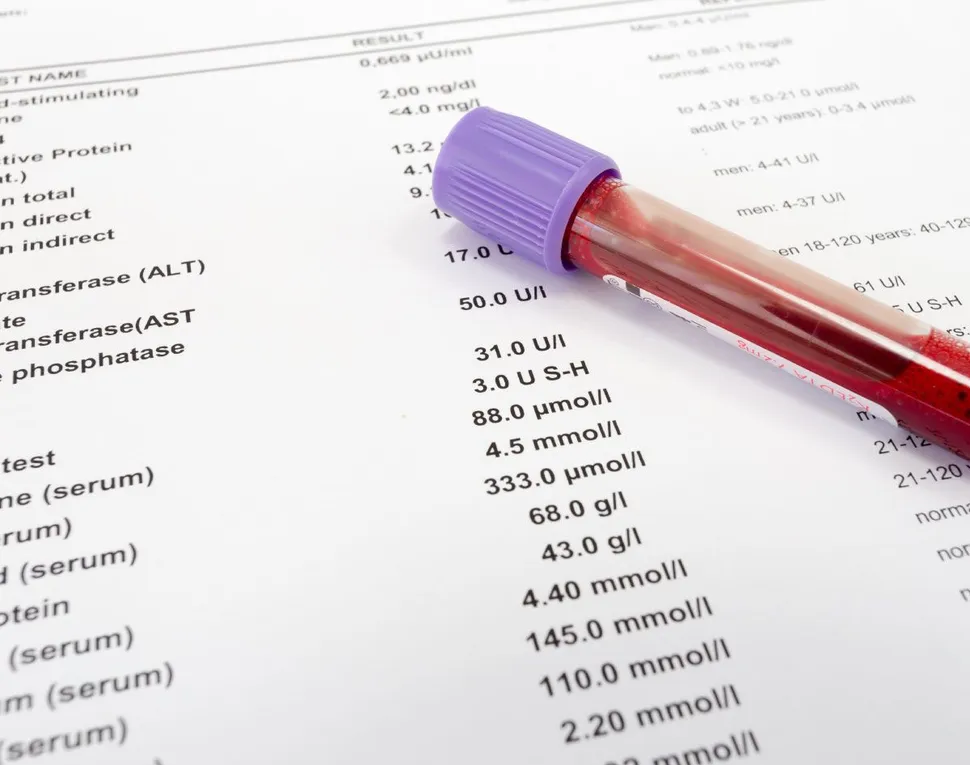 Watching Your Free Light Chain Ratio to Determine Smoldering Myeloma Progression to Active Myeloma image