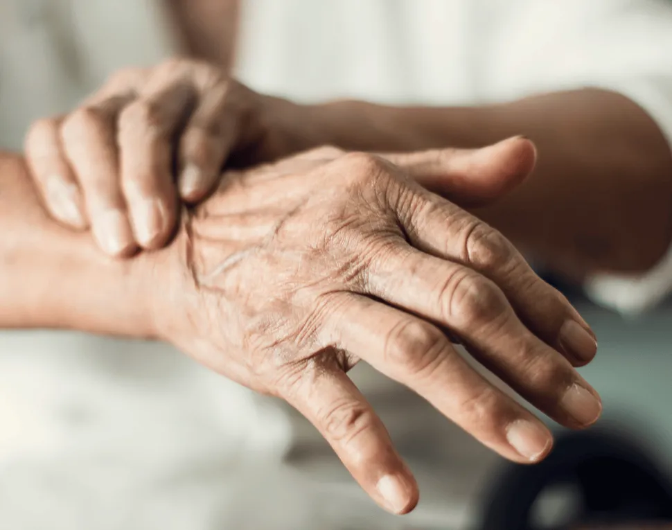 Rare Parkinsons-like Side Effect with BCMA CAR T in Myeloma image