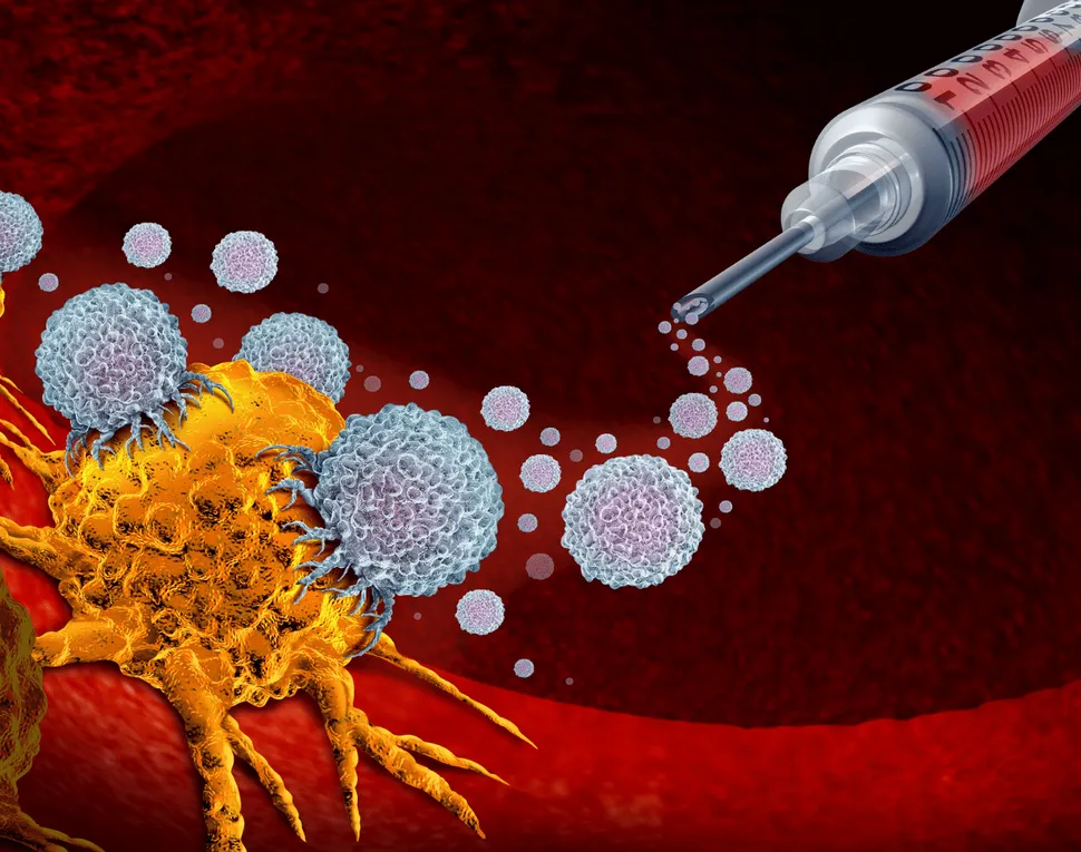 Cancer Vaccine Being Studied as a New AML Maintenance Therapy image