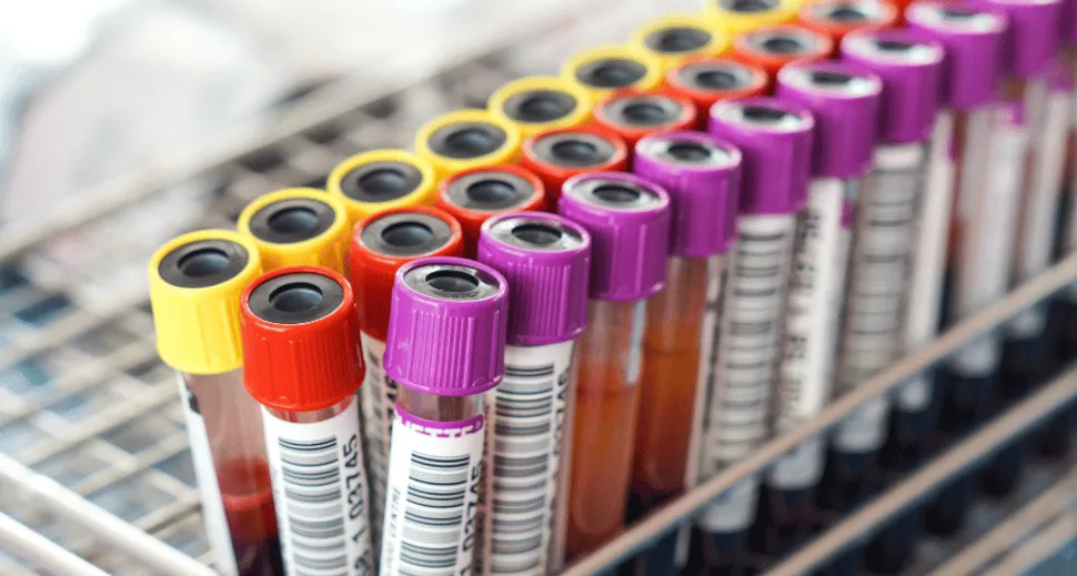 Blood-Based Single Cell Sequencing Holds the Key to Better Treatment Outcomes image