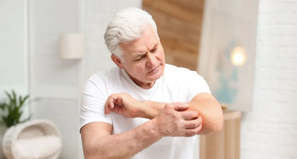 Itchy Skin And Kidney Disease image
