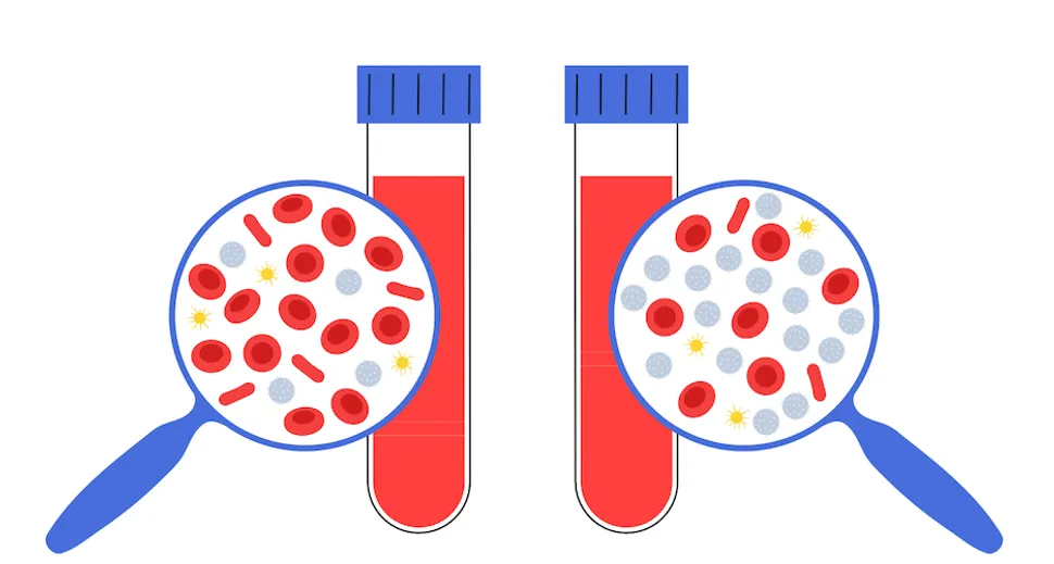 What is the Condition Before CLL? image