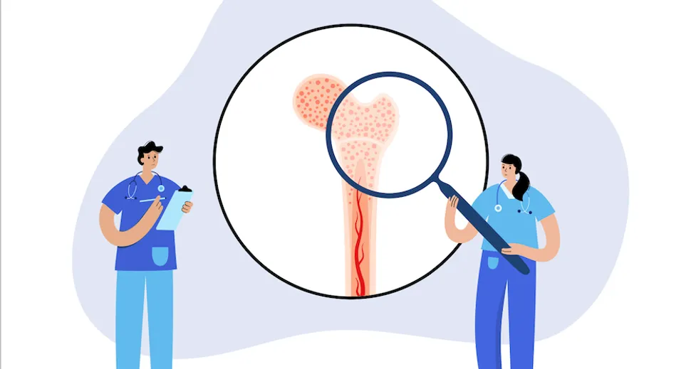 What are Myeloma Treatment Response Levels? image