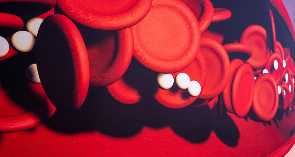 ASH 2022: New GPRC5D CAR T Therapy Shows Safety and Efficacy Even with Prior BCMA CAR T in Relapsed and Refractory Myeloma image