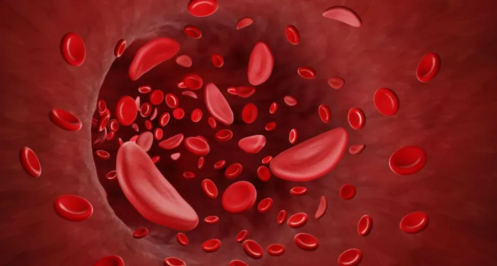 What Does Erythrocytosis Mean? image