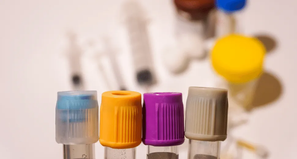 Phase 2 For Ziftomenib Begins for NPM1 Mutated AML image