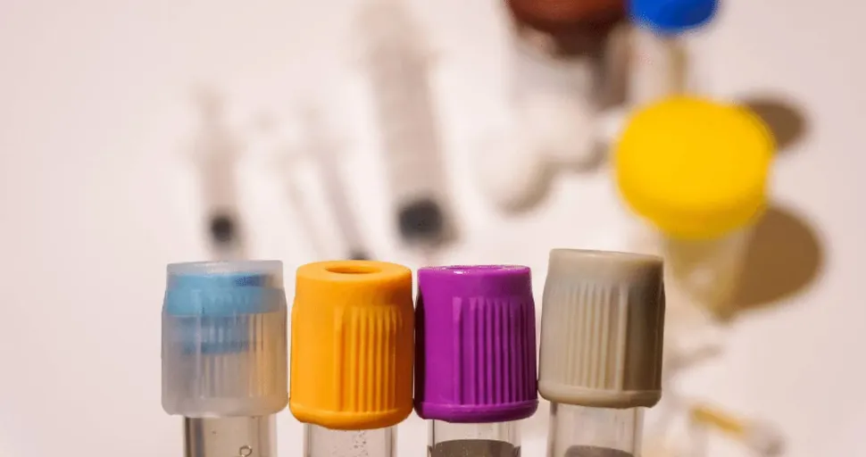 Ensayo Clínico: Evaluación del Metabolismo de la Glutamina en la GMSI y el Mieloma image