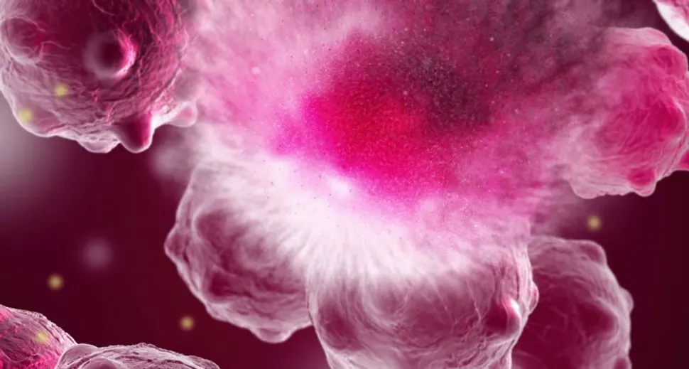 Diffuse Large B-Cell Lymphoma: Your Essential Questions Answered image