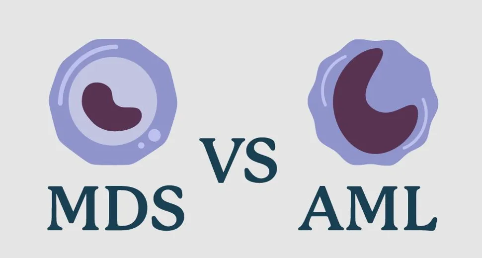 How Does MDS Turn into AML? image