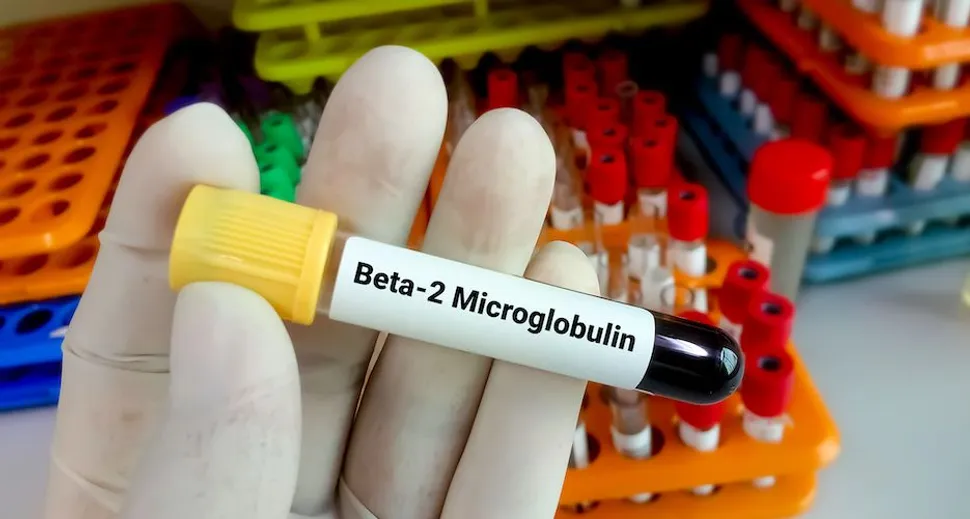 What is the Beta-2 Microglobulin Test for CLL? image