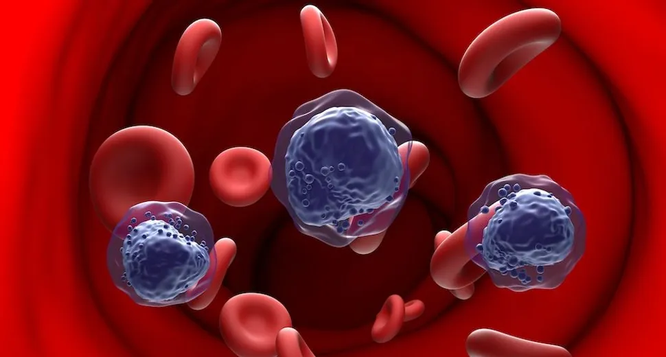 What are the Differences Between MDS and AML? image