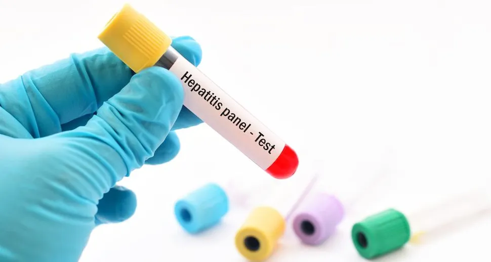 Hepatitis Test for CLL Patients image