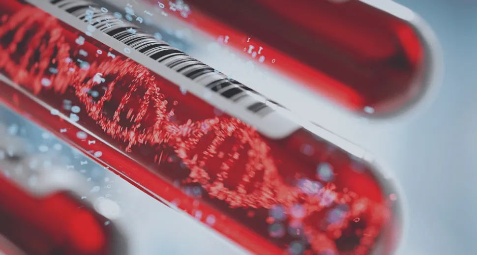 ASH 2022: MRD Blood-Based Testing in Multiple Myeloma image