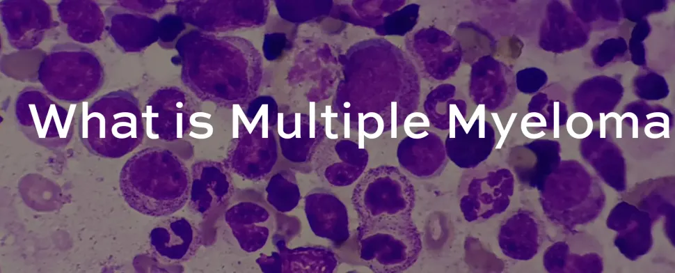 ¿Qué Es el Mieloma Múltiple? image