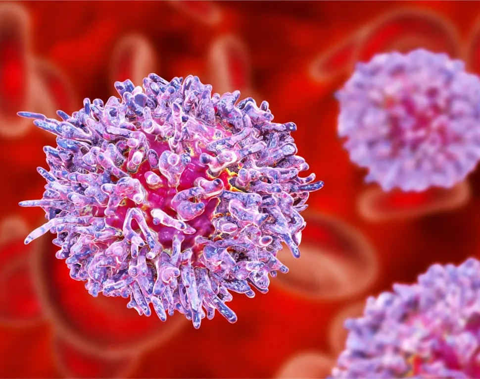 ASH 2020: State-Of-The-Art Care in Relapsed/Refractory Multiple Myeloma image