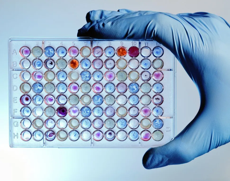 Which Myeloma Drug will You Respond To? Mayo Clinic Scottsdale Researchers Develop New Test image