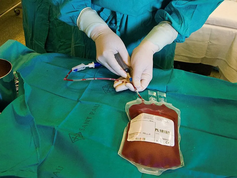 Are Stem Cell Transplants Still a Preferred Treatment For Myeloma? A Study Says YES image