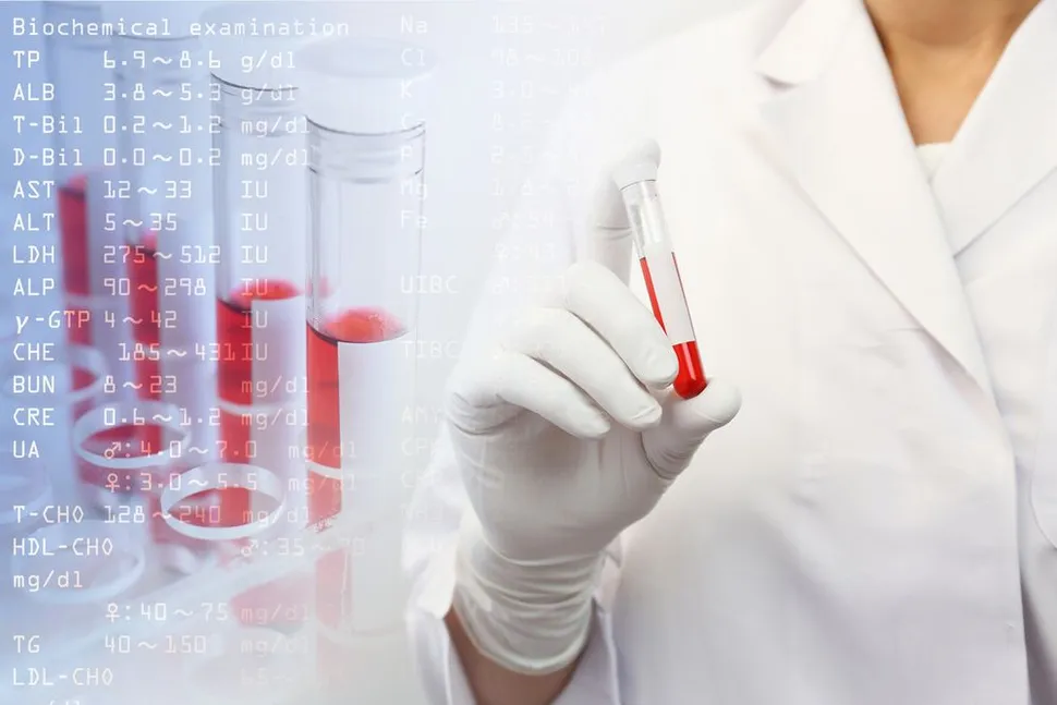 Uncovering MGUS Mysteries: Should We Be Screening More for MGUS? image