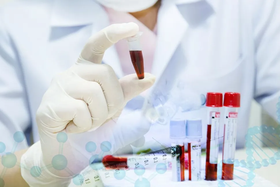 Progress in the Development of 'Liquid Biopsies' in Multiple Myeloma image