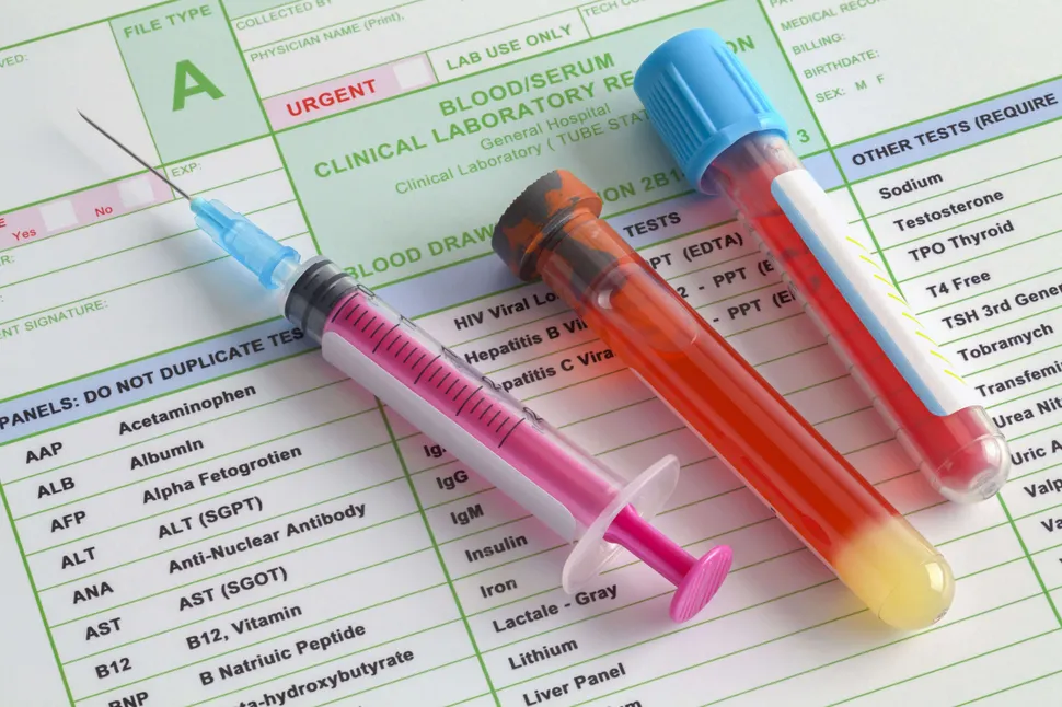 ASH 2017: Quick ‘Do-It-Yourself’ M-Spike Calculation, the Gamma Gap image