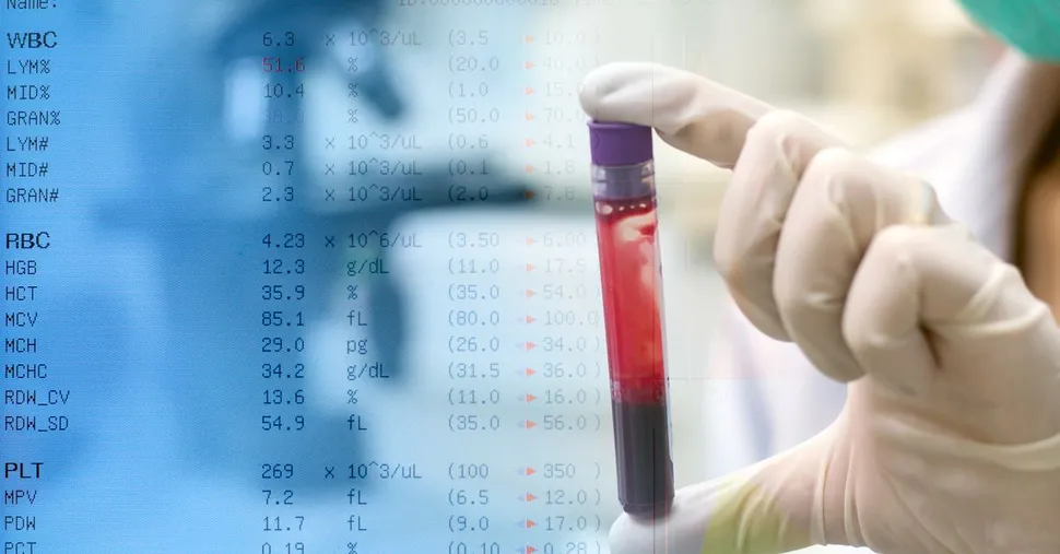 ASH 2017: Changes in Blood BCMA Antigen Levels Rapidly Indicate Changes in Clinical Status Among Multiple Myeloma Patients Undergoing New Treatments image
