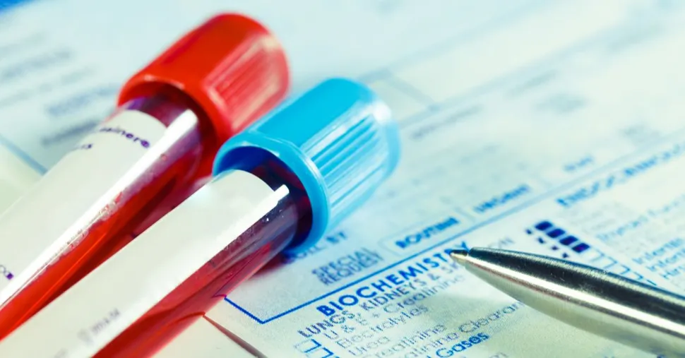 New Test for Daratumumab (Darzalex) Patients Helps With M-Protein Accuracy image