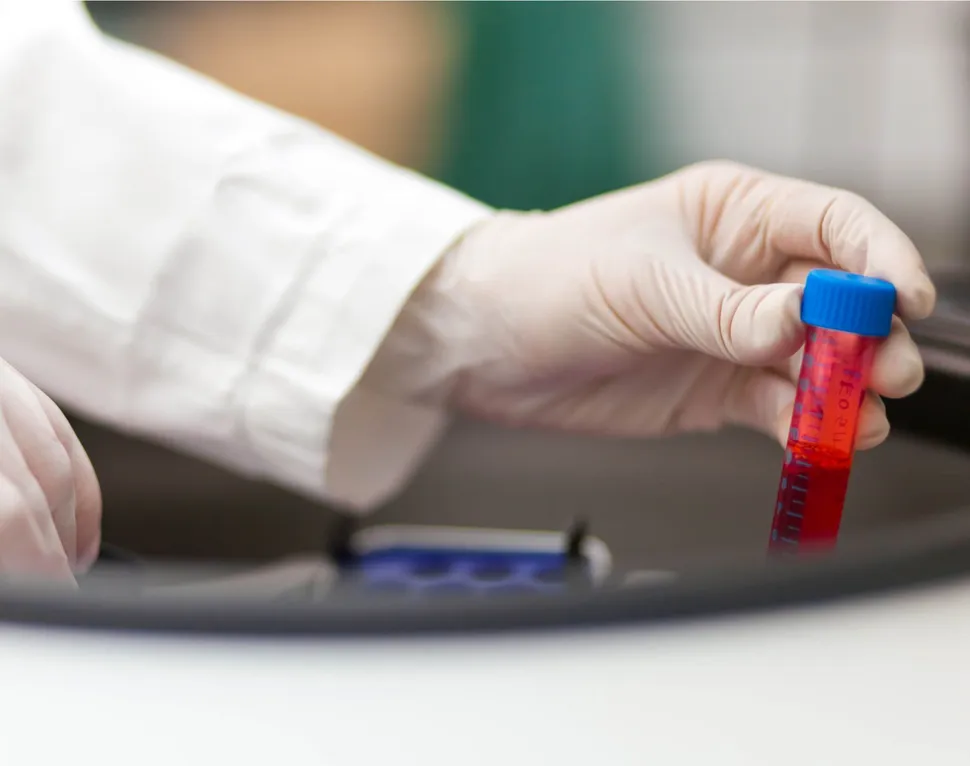 Clinical Trial: Phase 1 BCMA-CD3 Bispecific Antibody for Relapsed/Refractory Myeloma Patients image