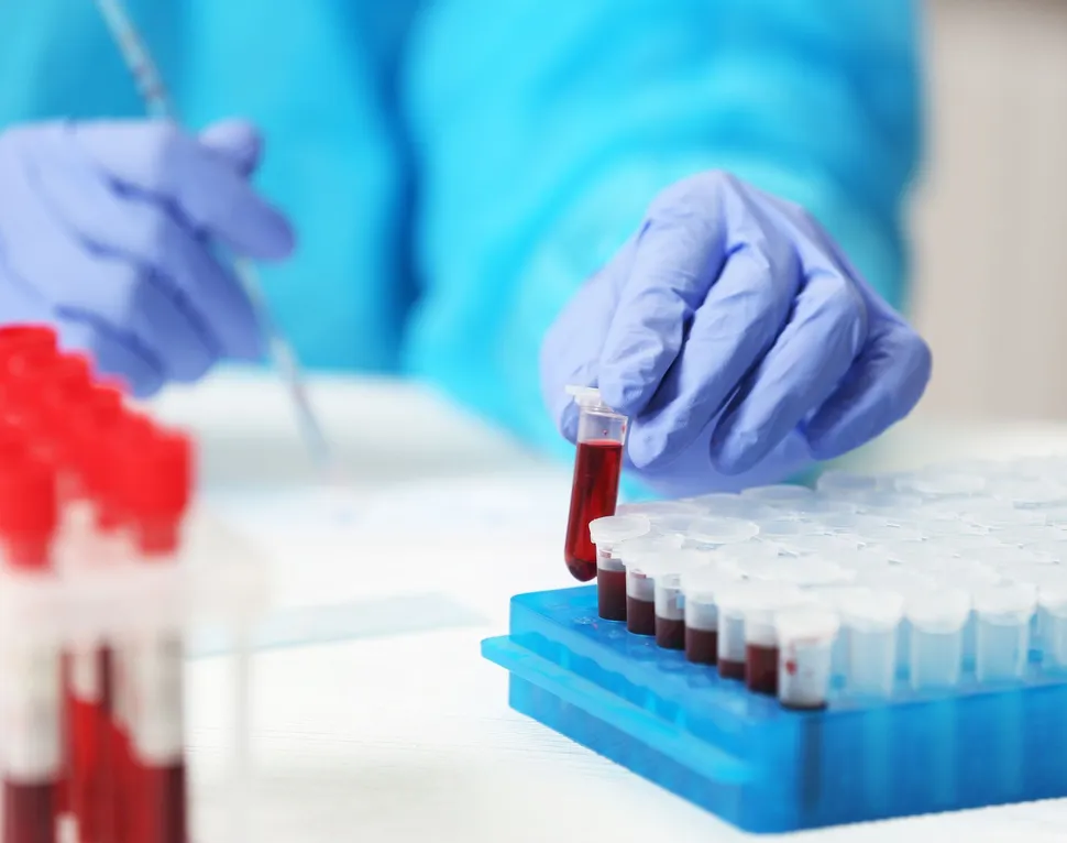 Minimal Residual Disease Testing in Multiple Myeloma image