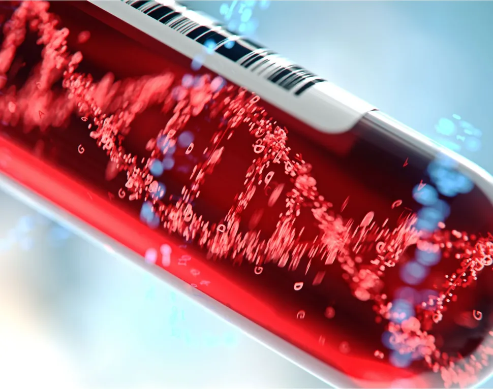 A Better Way to Detect Track Multiple Myeloma Using a New Blood Test image