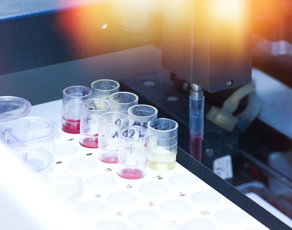 Sanofi and Sebia Develop New Monoclonal Protein Detection Test in Multiple Myeloma image