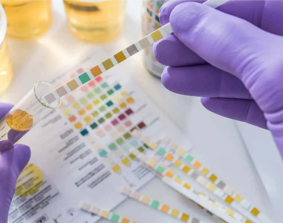 What Tests are Used to Monitor Myeloma? image