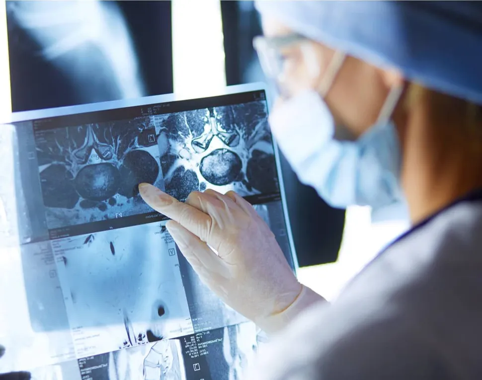 HealthTree University: Myeloma Bone Disease (Part 3 of 5) image