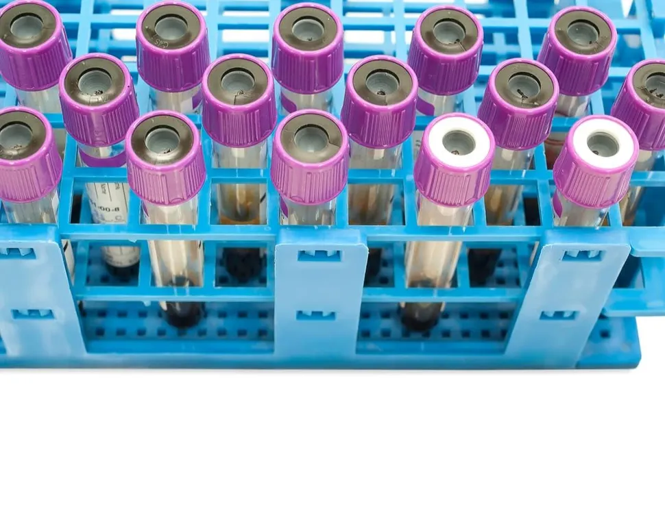 Using Flow Cytometry Marker CD200 to Predict Multiple Myeloma Outcomes image