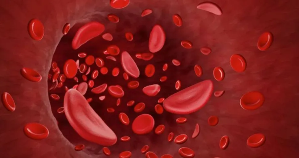 ¿Que es la anemia en el mieloma? image