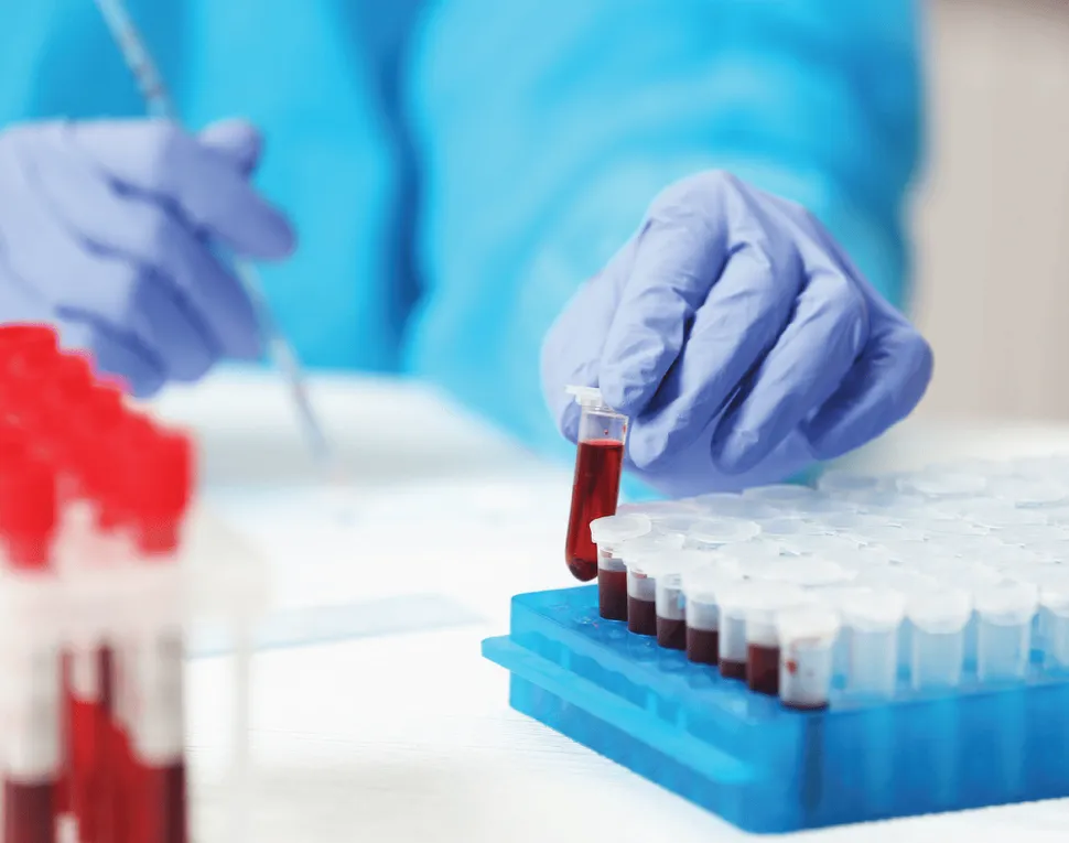 Spotlight on Minimal Residual Disease (MRD) Testing image