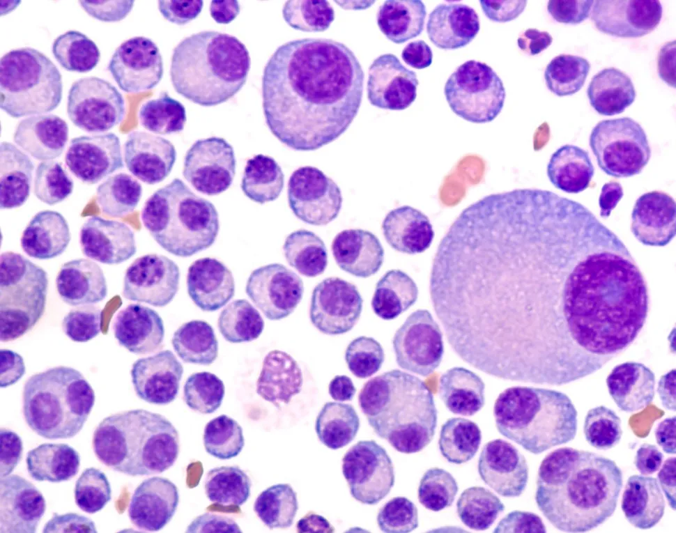 HealthTree University: Multiple Myeloma Basics Part 1 (1 of 3) image